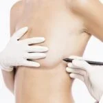 surgary_serv_04-150x150